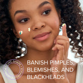 Maree pimple and acne patches on clear skin, showing their discreet, fast-acting design for acne treatment.