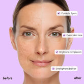 Maree Dark Spot Corrector face serum bottle with dropper, designed to reduce dark spots and even skin tone.