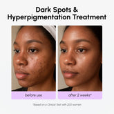 Maree Dark Spot Corrector face serum with TXA, showing a sleek bottle with dropper applicator on a neutral background.
