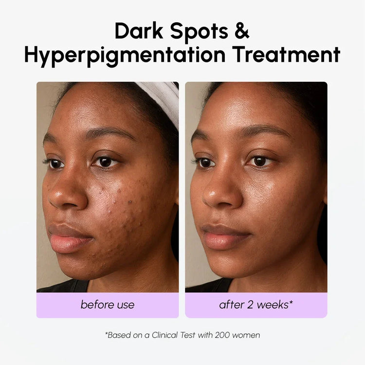 Maree Dark Spot Corrector face serum with TXA, showing a sleek bottle with dropper applicator on a neutral background.