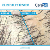 CeraVe Anti-Dandruff Hydrating Conditioner in 12 oz bottle, moisturizing hair conditioner for dandruff relief and scalp hydration.