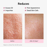 Maree hydrating pore refining toner bottle with clear liquid, designed for smooth, flawless skin and minimizing pores.