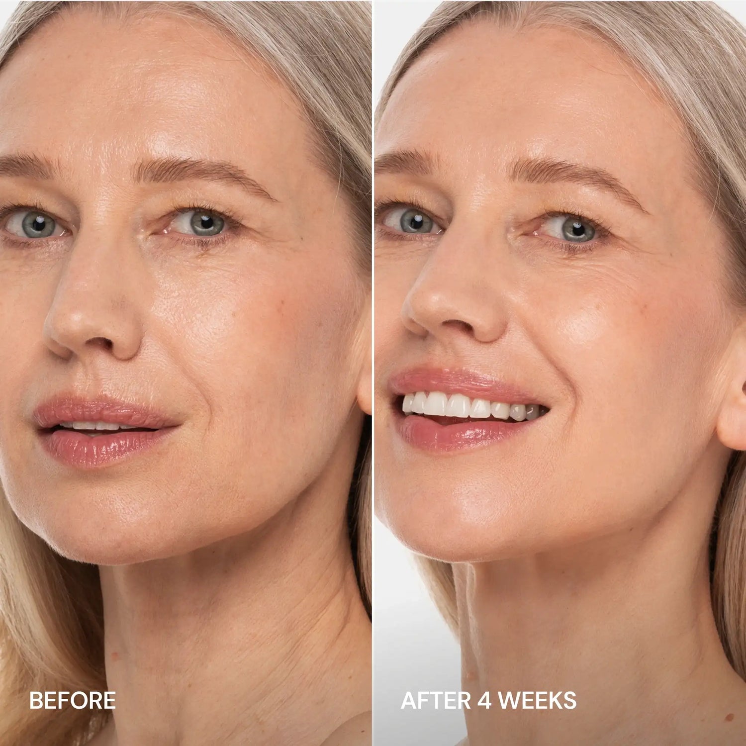Maree Pro-Retinol Neck Lifting Cream Massager with ergonomic design for anti-aging facial and neck skincare.