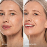 Maree Pro-Retinol Neck Lifting Cream Massager with ergonomic design for anti-aging facial and neck skincare.