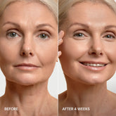 Maree Pro-Retinol Neck Lifting Cream Massager showing a close-up of the device used on the neck area.