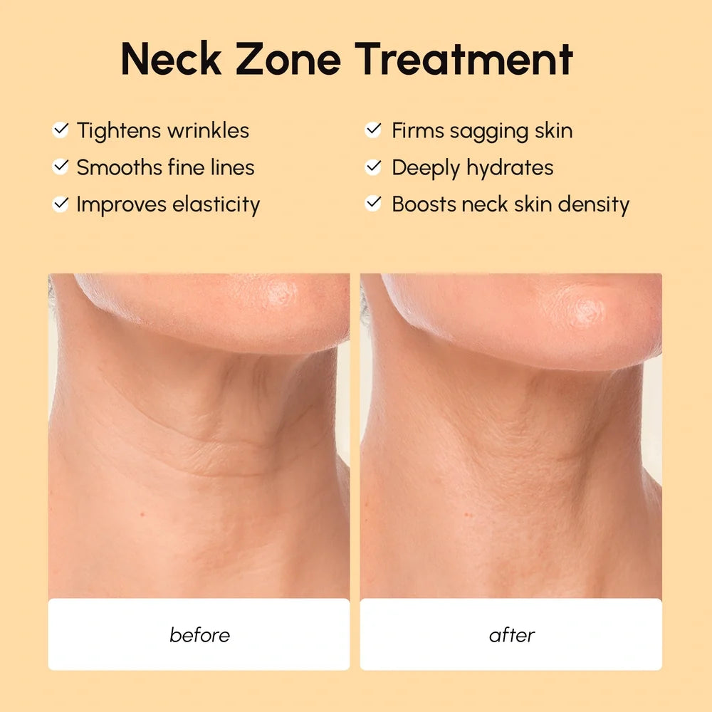 Maree lifting neck wrinkle patches applied to the neck showing a close-up view of the skincare treatment.
