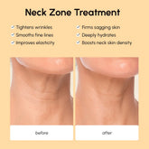 Maree lifting neck wrinkle patches applied to the neck showing a close-up view of the skincare treatment.
