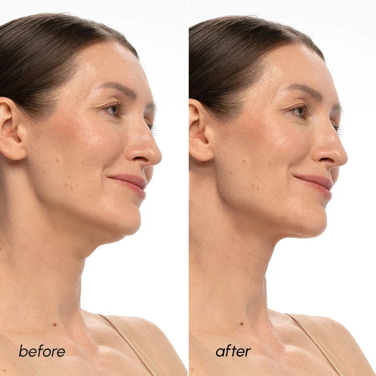 Maree PDRN V-line Lifting Mask showing the mask&