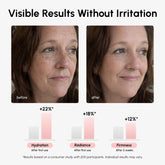 Maree Firming & Renewing PDRN Serum bottle, anti-aging glow booster with serum dropper, skincare for firm and radiant skin