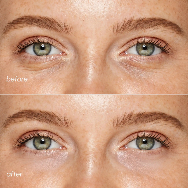 Pink Maree eye patches for puffy eyes, showing soft pink gel patches designed to reduce puffiness and refresh the eye area.