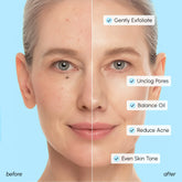 Maree glycolic and salicylic acid peel pads for clear, smooth skin, shown in a close-up image of the product packaging