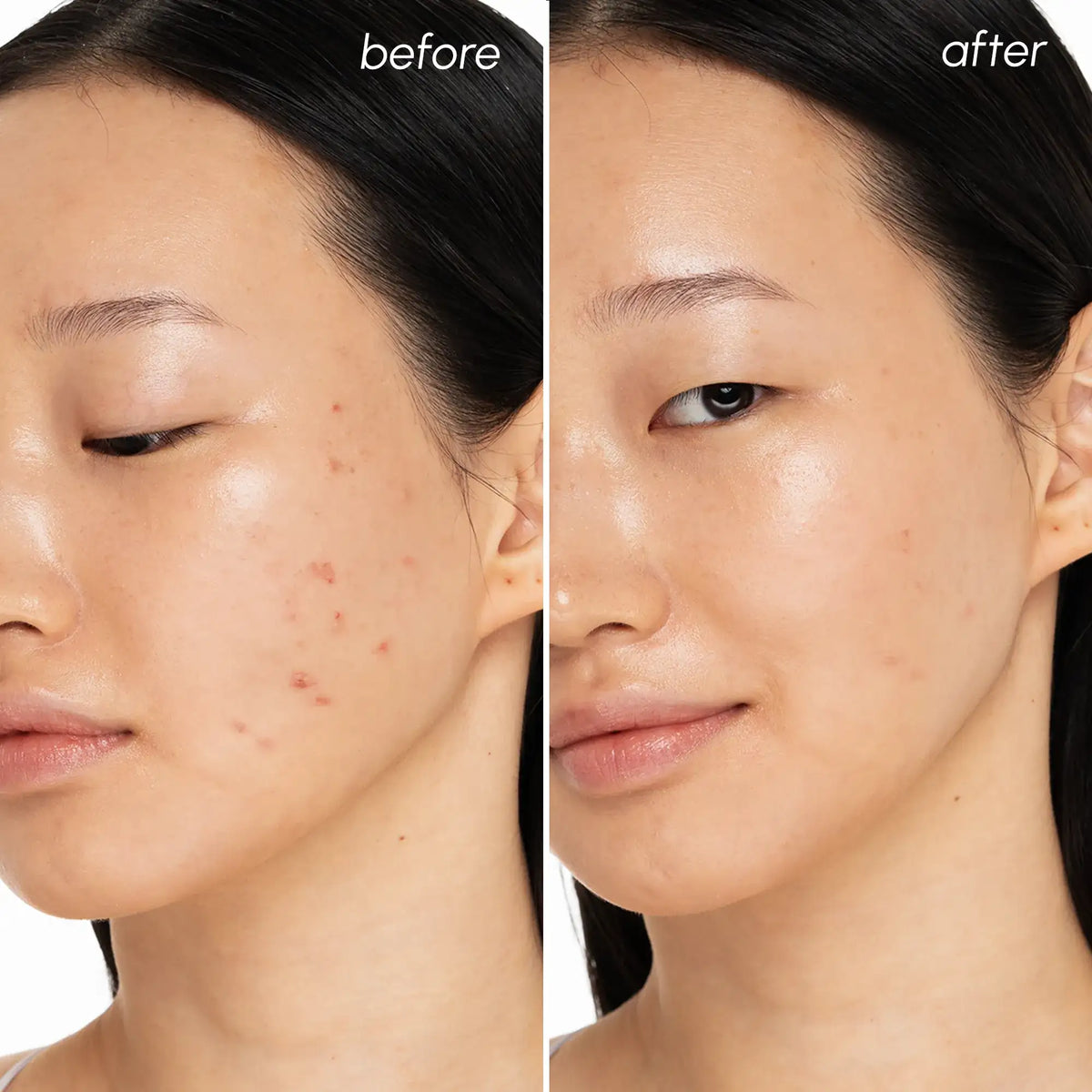 Maree Witch Hazel Clearing Pads for refreshing daily skin care, showing a close-up of the product with pads and packaging.