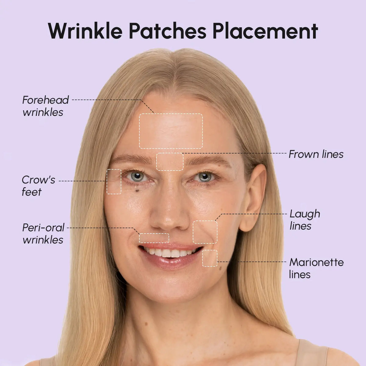Maree anti-wrinkle tape patches applied to skin to reduce fine lines and wrinkles, showing a close-up of the facial area.