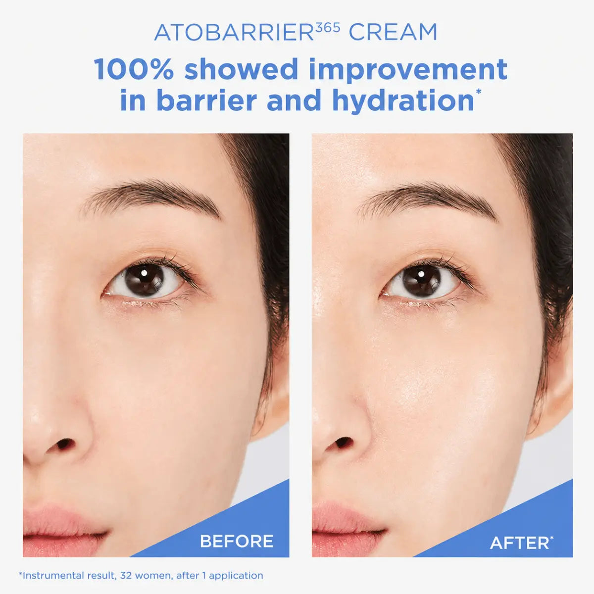 Korean OTC AESTURA Atobarrier365 Cream in a white tube with blue accents, designed for barrier repair and skin protection.