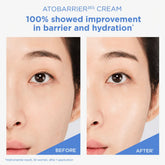 Korean OTC AESTURA Atobarrier365 Cream in a white tube with blue accents, designed for barrier repair and skin protection.