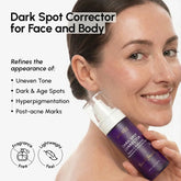 Maree Face & Body Serum for Dark Spots showing a sleek bottle with serum, designed for brightening skin on face and body.