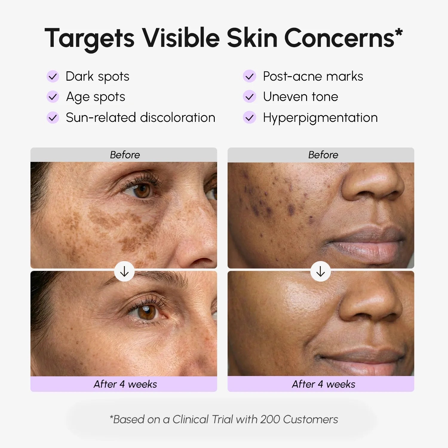 Maree Face and Body Serum for Dark Spots, featuring a sleek bottle with dropper, designed to reduce dark spots and even skin tone.