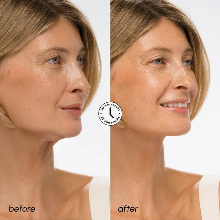 Maree Hyaluronic Acid V-line Lifting Mask demonstrating a skincare mask designed for facial lifting and hydration.