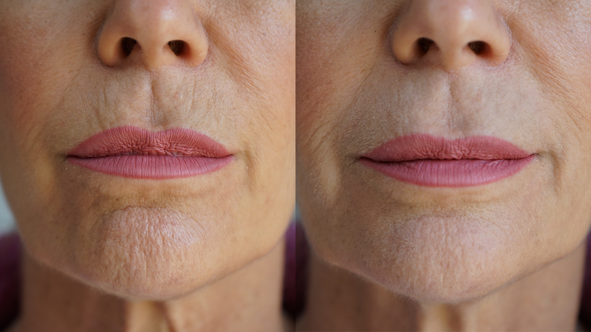 PRAI Beauty Ageless Lip & Line Filler tube showing the 8ml applicator for smoothing lips and fine lines.